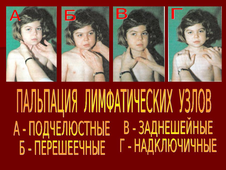 НАДКЛЮЧИЧНЫЕ ЛИМФАТИЧЕСКИЕ УЗЛЫ images
