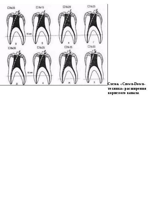 Цели и задачи эндодонтического лечения зуба