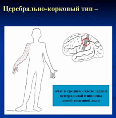 Нарушения чувствительности, причины, симптомы и лечение | Заболевания нервной системы