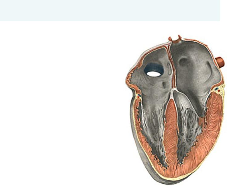 Наличие хорды у человека. Сухожильные хорды сердца анатомия. Дополнительная трабекула левого желудочка. Мясистые трабекулы правого желудочка. Правое предсердие анатомия.