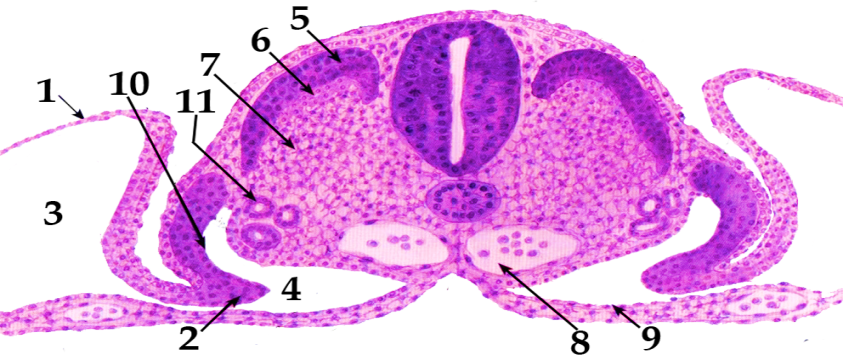 Эмбрион гистология. Туловищная и амниотическая складки зародыша курицы. Образование туловищной и амниотической складок у зародыша курицы. Туловищная и амниотическая складки зародыша курицы препарат. Зародыш курицы гистология.