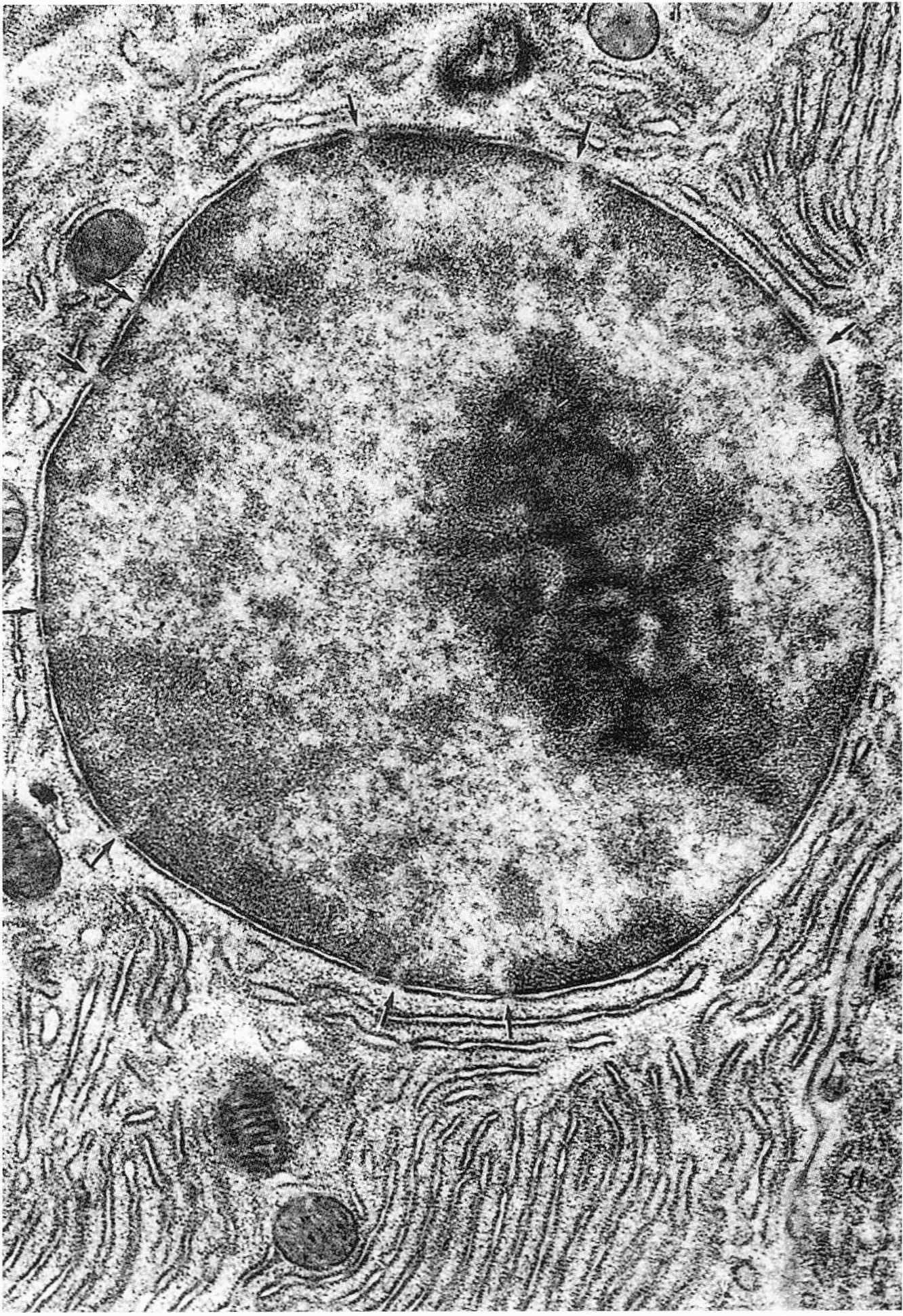 В ядрах клеток многоклеточного. Ядрышко клетки. Эухроматин и гетерохроматин. Клеточное ядро. Yadro клетки.