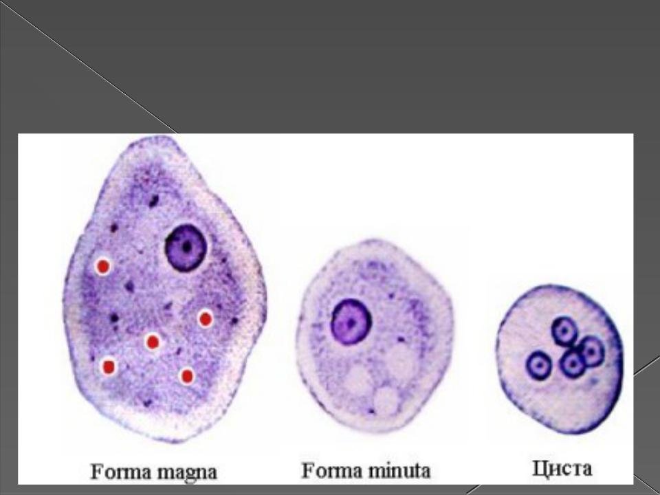Дизентерийная амеба систематика. Дизентерийная амеба иммунитет. Тканевая форма дизентерийной амебы. Дизентерийная амеба минута. Кишечная амеба и дизентерийная отличия.