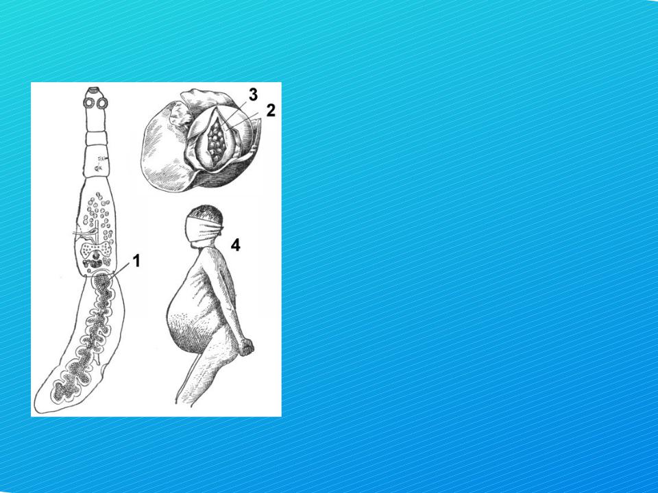 Цифрой обозначено на рисунке яйцо эхинококка. Эхинококк рисунок. Эхинококк строение рисунок. Эхинококкоз человека плакат.