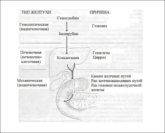 Печеночная желтуха это Печеночная желтуха это