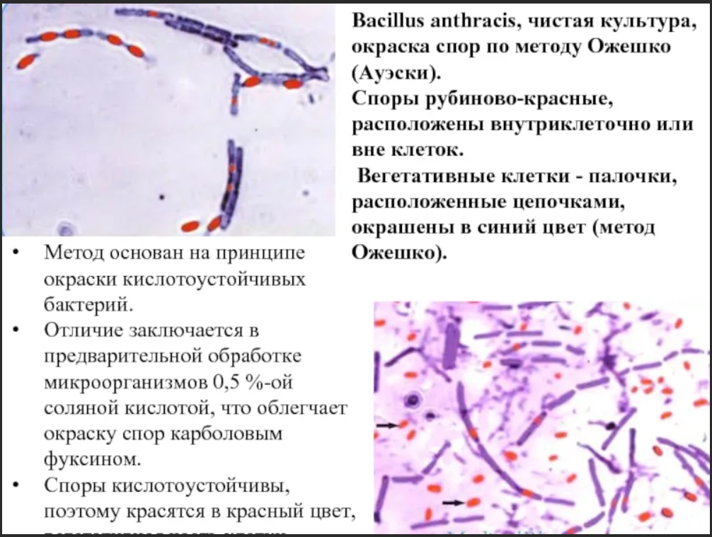 Окраска спор бактерий. Метод выявления спор по Ожешко. Окраска Ожешко Bacillus anthracis. Окраска клостридий по Ожешко. Спор бацилл по Ожешко.