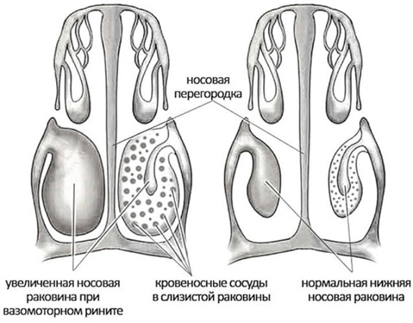 46.Строение слизистой оболочки носа. Источники влаги в носу.
