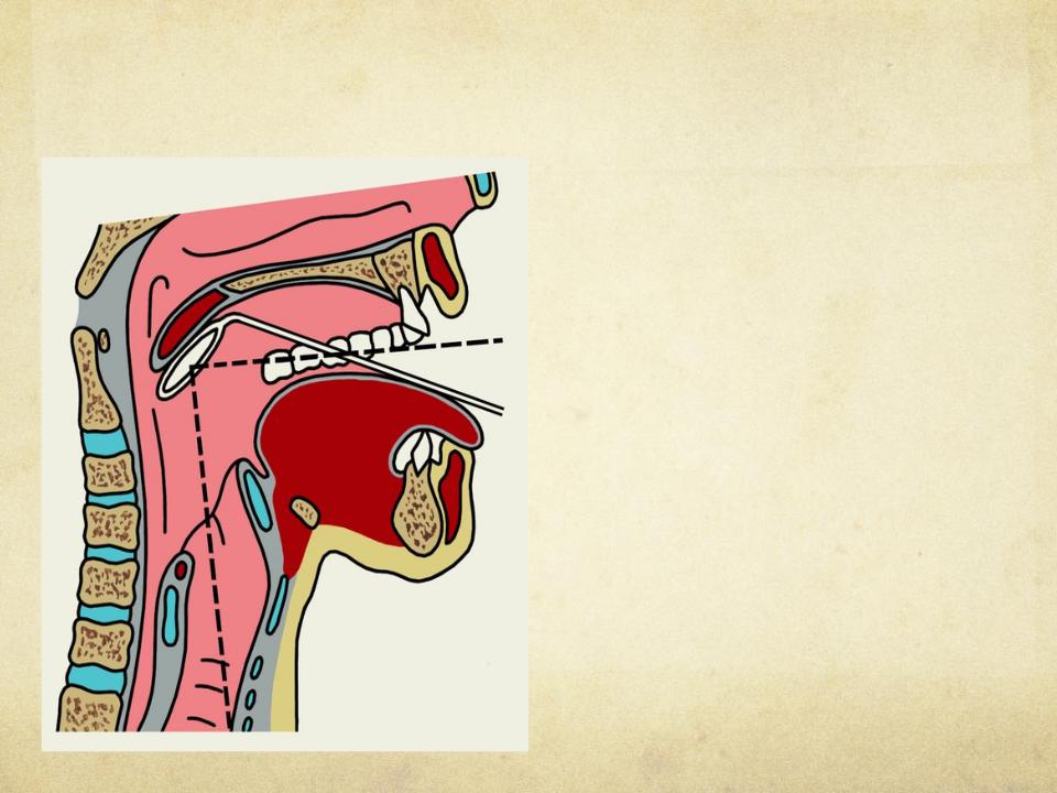 Гортань клиника. Стеноз гортани ларингоскопия. Надгортанник непрямая ларингоскопия. Ларингоскопия надгортанника. Непрямая ларингоскопия анатомия.